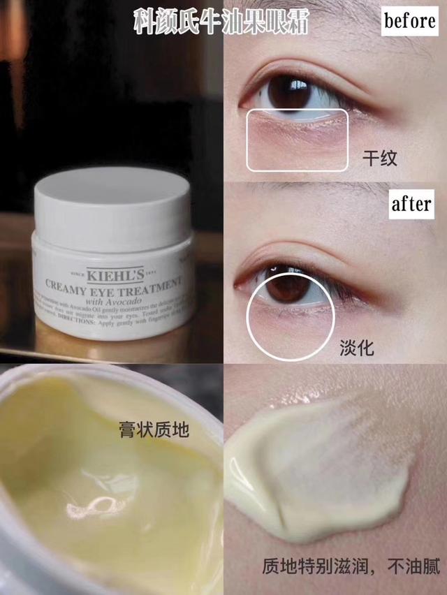 KIEHL'S科顏氏牛油果眼霜真的好用嗎——還你一雙明眸