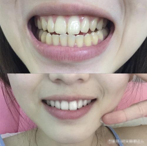 李佳琦力薦的“牙膏”火了，效果賊好，網友：牙膏中的香奈兒