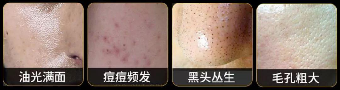 歐萊雅“控油凍”洗面奶，控油、潔凈、清爽，秒變精致男