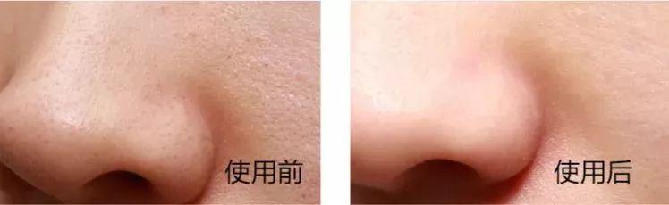 歐萊雅“控油凍”洗面奶，控油、潔凈、清爽，秒變精致男