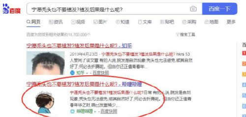 霸屏新陣地，1分鐘百度收錄并排首頁技術