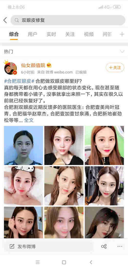 醫美行業微博熱門引流六大技巧 流量 微博 經驗心得 第3張